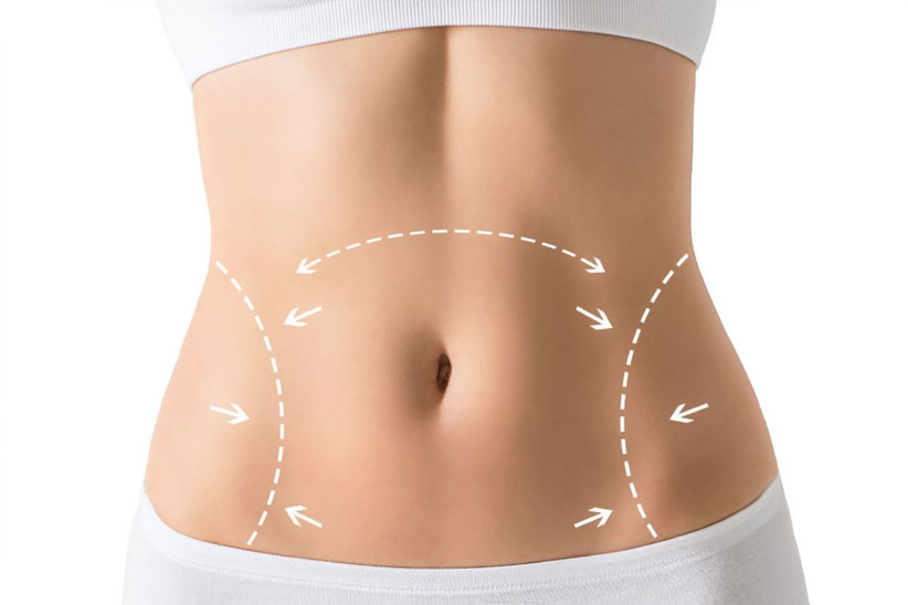 Exploring the Aesthetic Miracles of Tummy Tuck Procedures